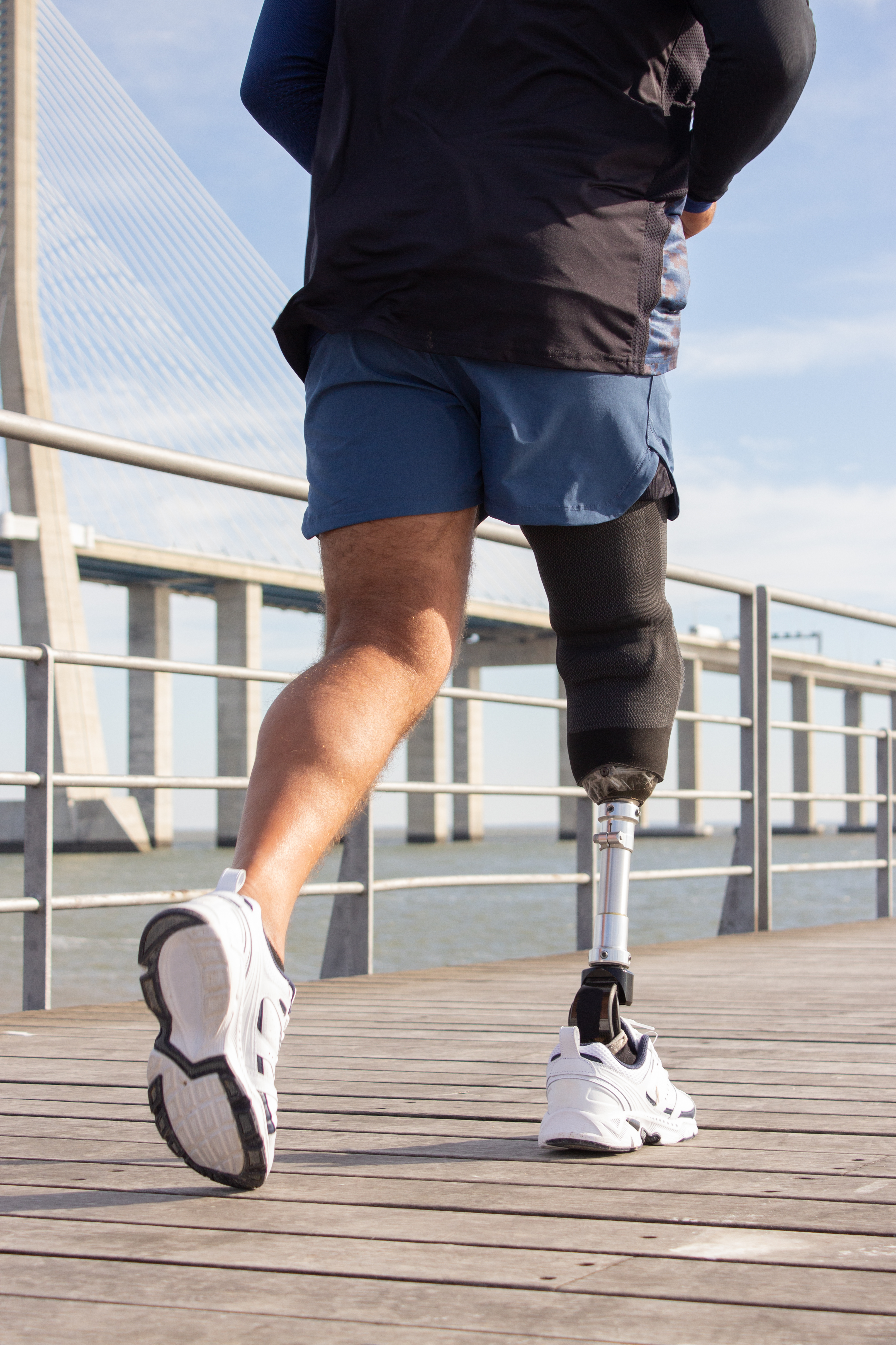 Prosthetic fitting